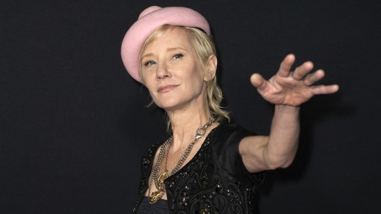 Anne Heche padece muerte cerebral